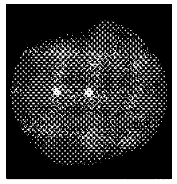 Sensitivity-enhanced optical time domain reflection distributed Michelson interferometer based on two-core optical fiber