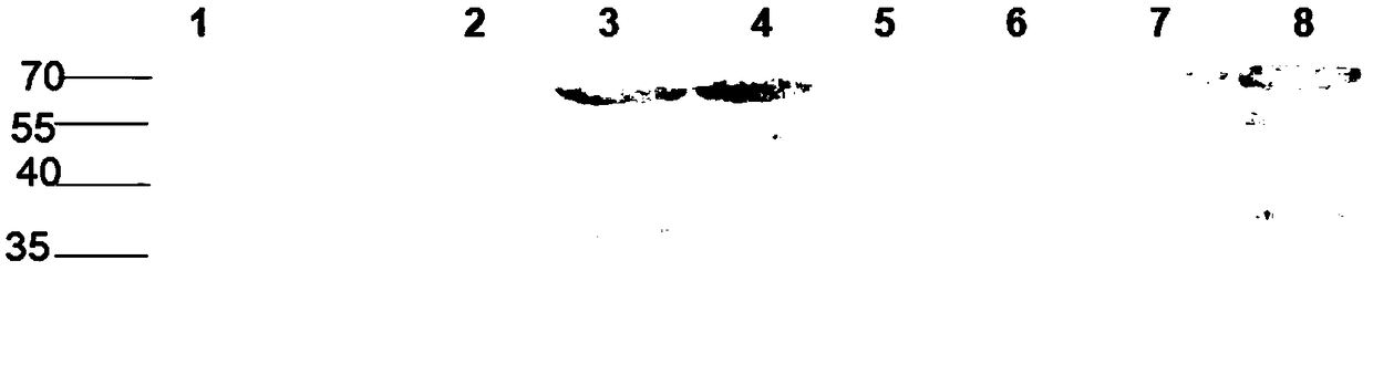 Immunogenic polypeptide of 71-type VP1 antigen of enterovirus, preparation method and application thereof