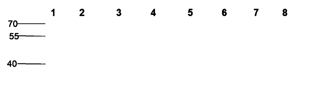 Immunogenic polypeptide of 71-type VP1 antigen of enterovirus, preparation method and application thereof