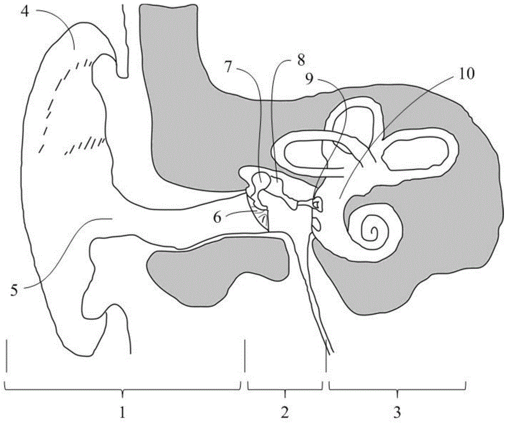 Novel hearing compensation actuator