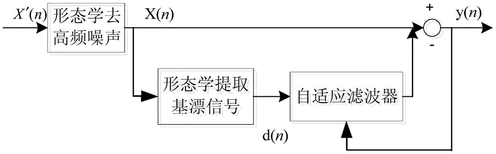 Feature extraction and classification system and method for gastric magnetic signals