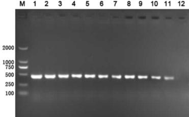 EMA-PCR (Ethidium Monoazide-Polymerase Chain Reaction) detection method of viable pathogen in farm environment