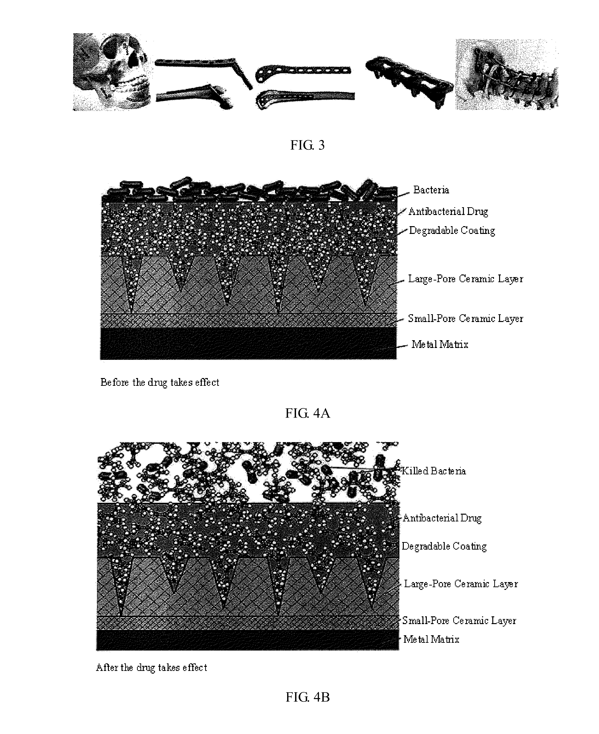 Multifunctional composite drug coating sustained release system and method for manufacturing same