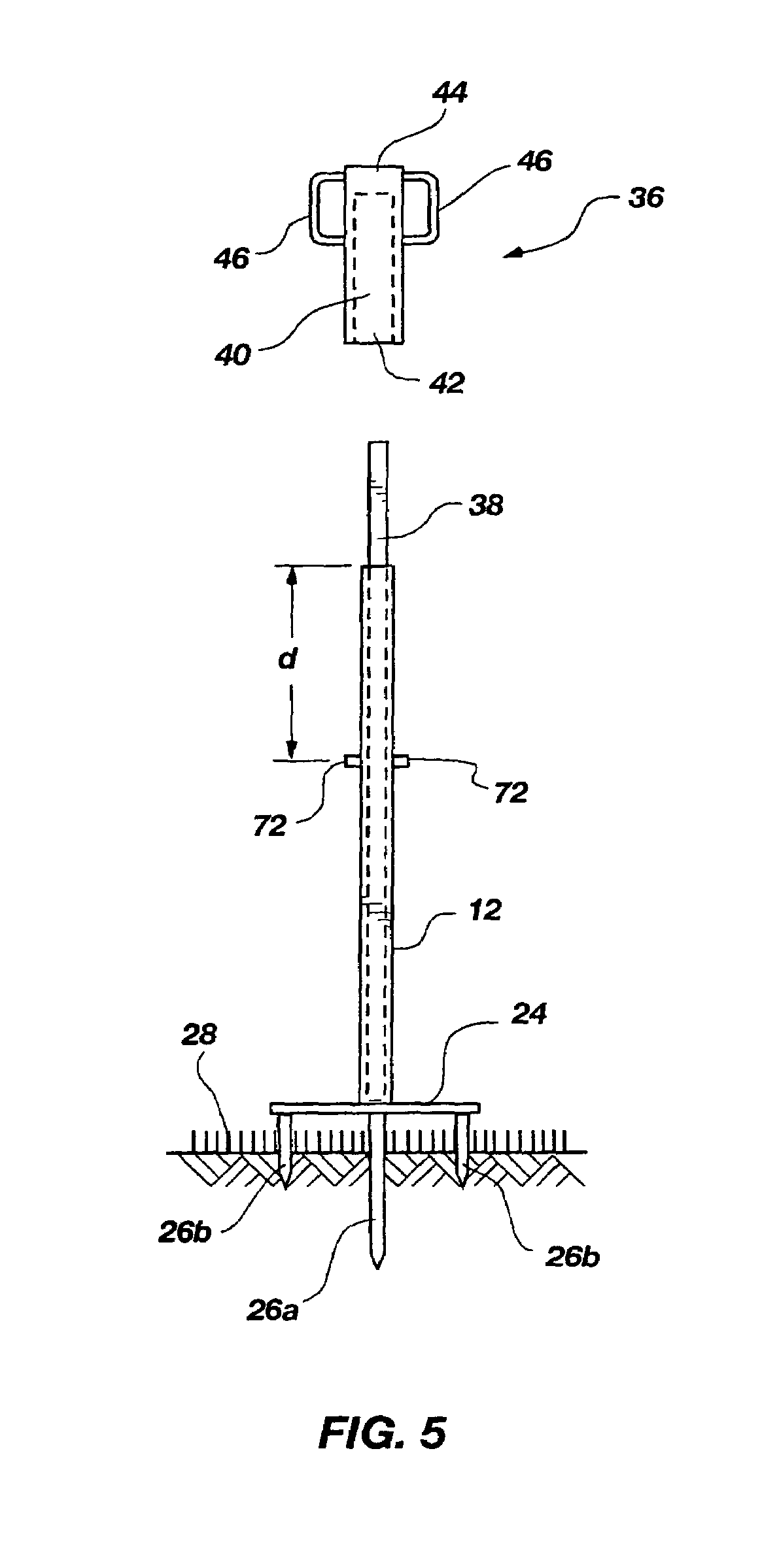 Removable sign support system