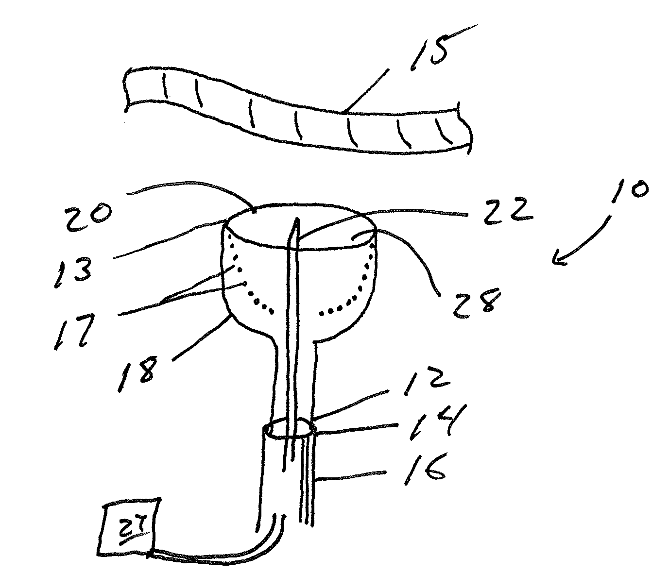 Safe tissue puncture device