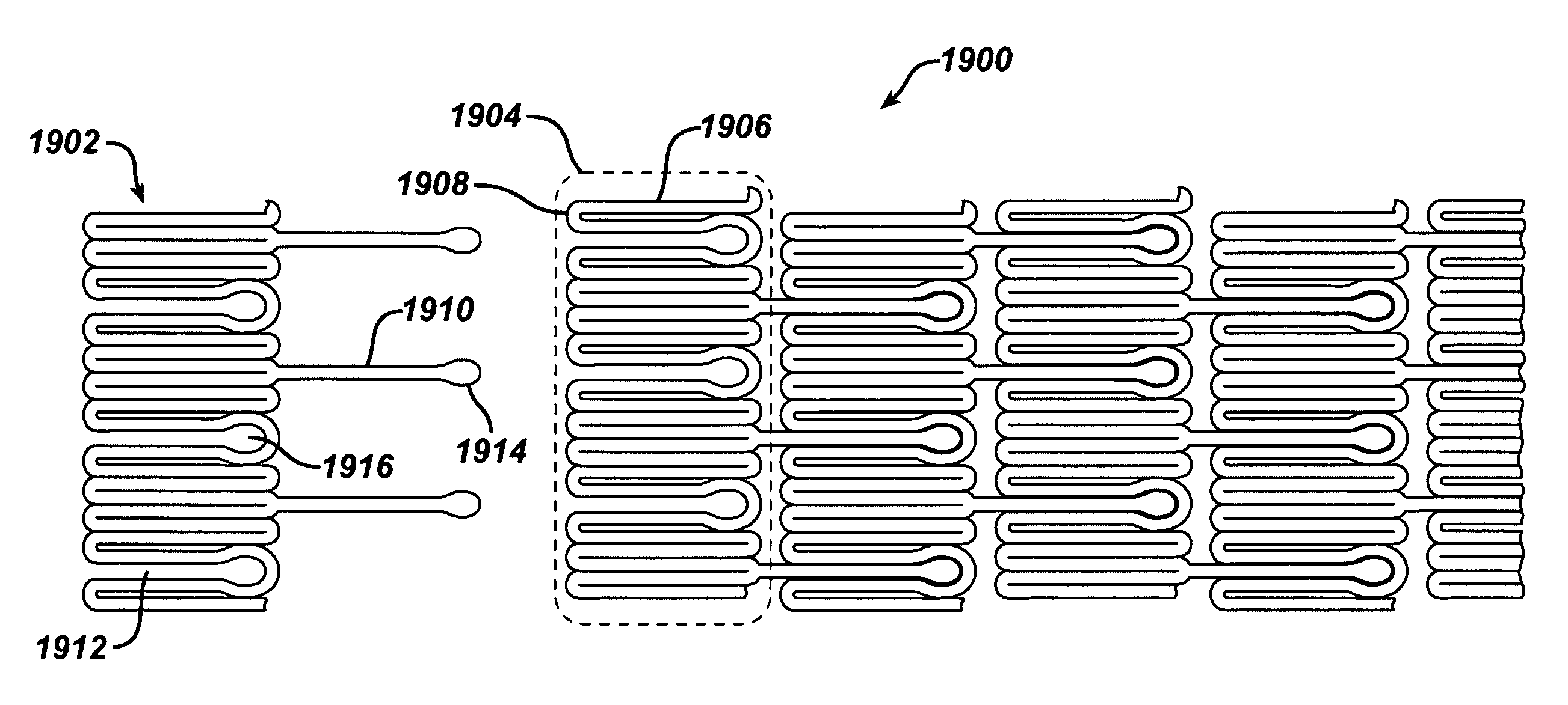 Stent design having stent segments which uncouple upon deployment