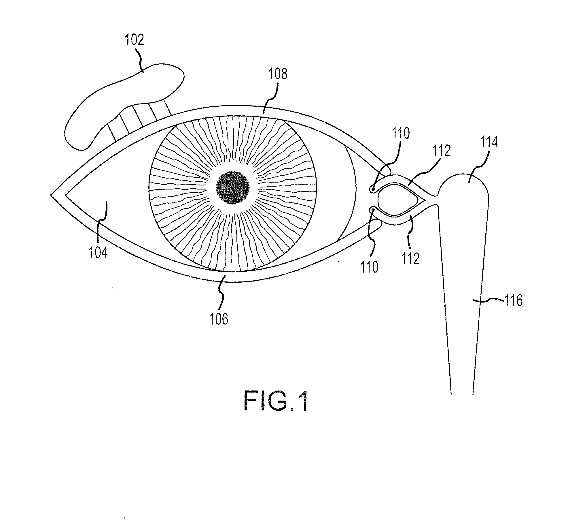 Implantation tools, tool assemblies, kits and methods