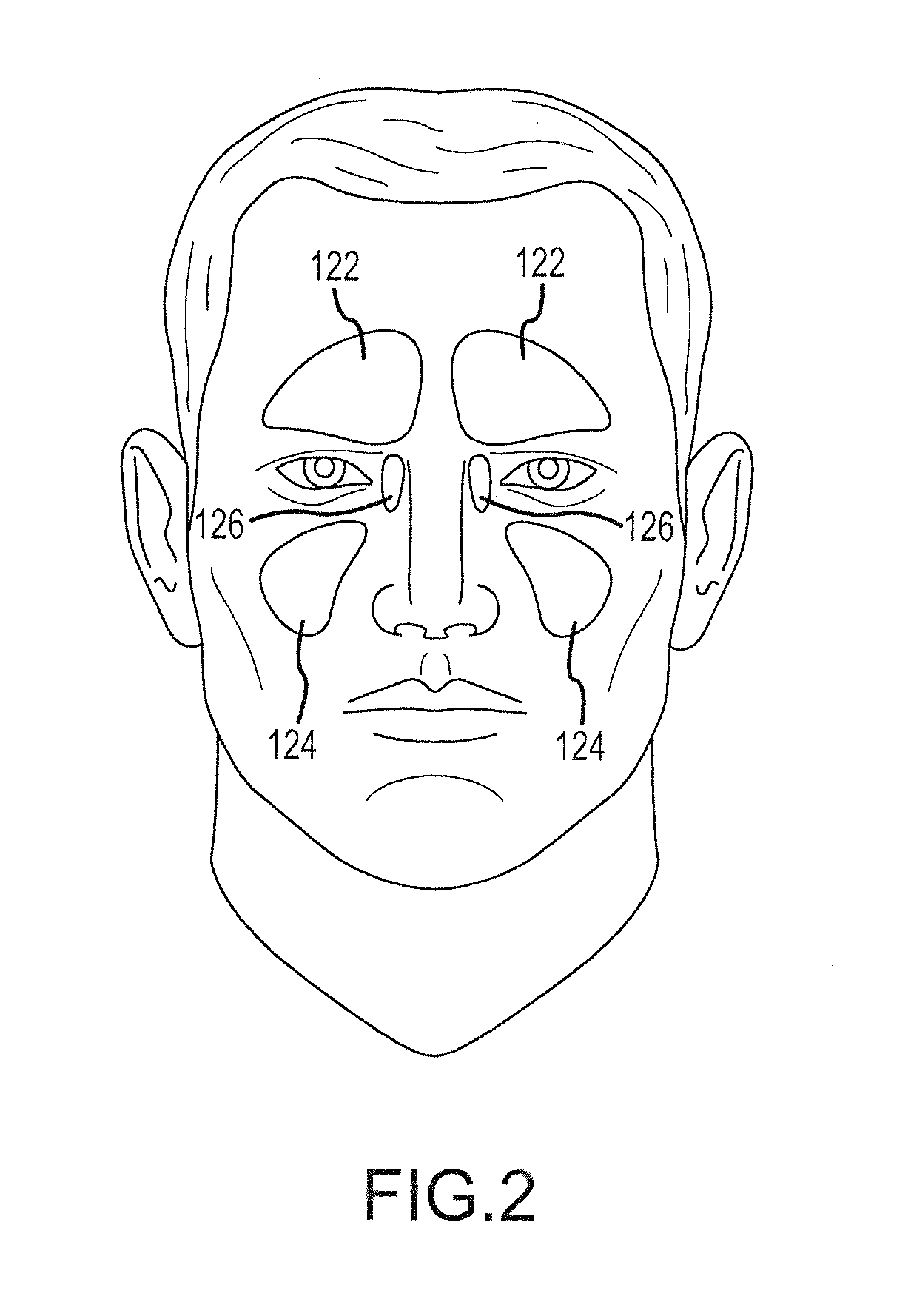 Implantation tools, tool assemblies, kits and methods