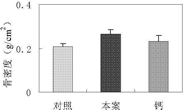 Health care product containing vitamin K2 and having functions of preventing and treating brittle-bone disease