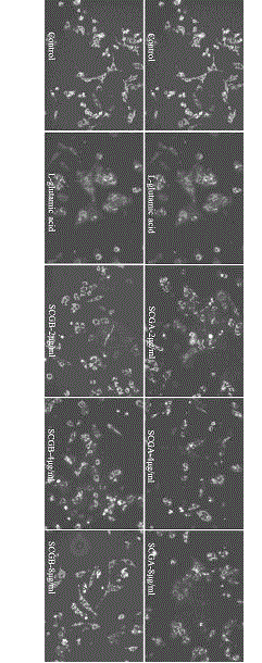 Application of sparassis crispa polysaccharide extracts to preparing medicines for treating neurodegenerative diseases