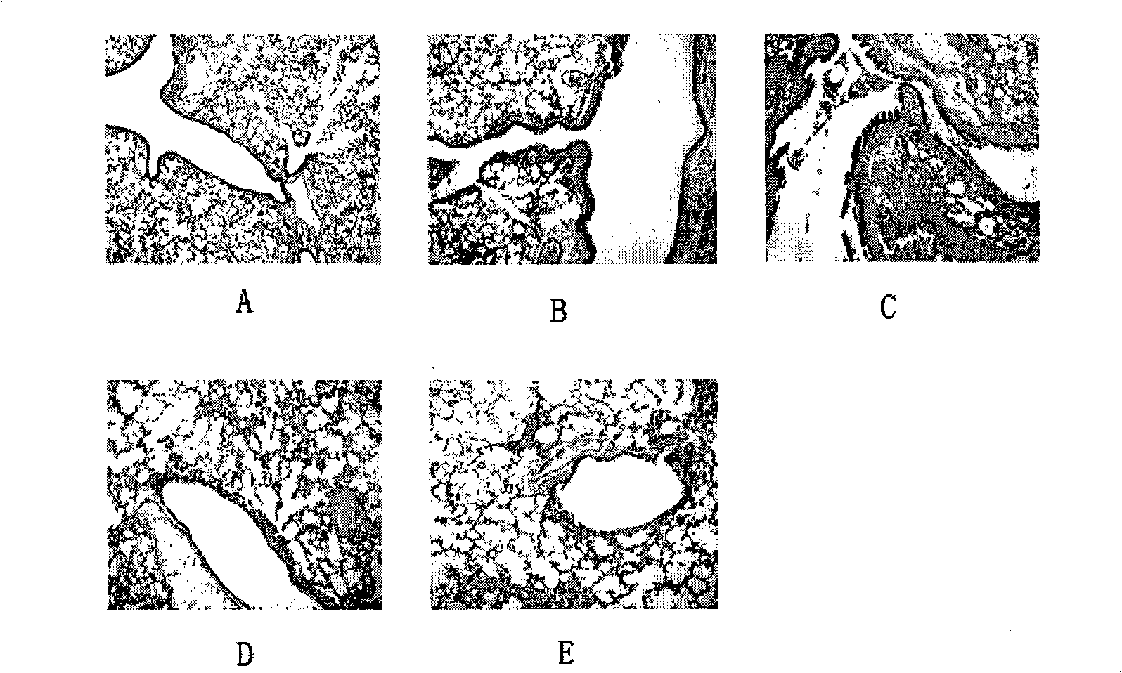 Clerodendrum bungei extract and use thereof for treating airway hyperreactivity