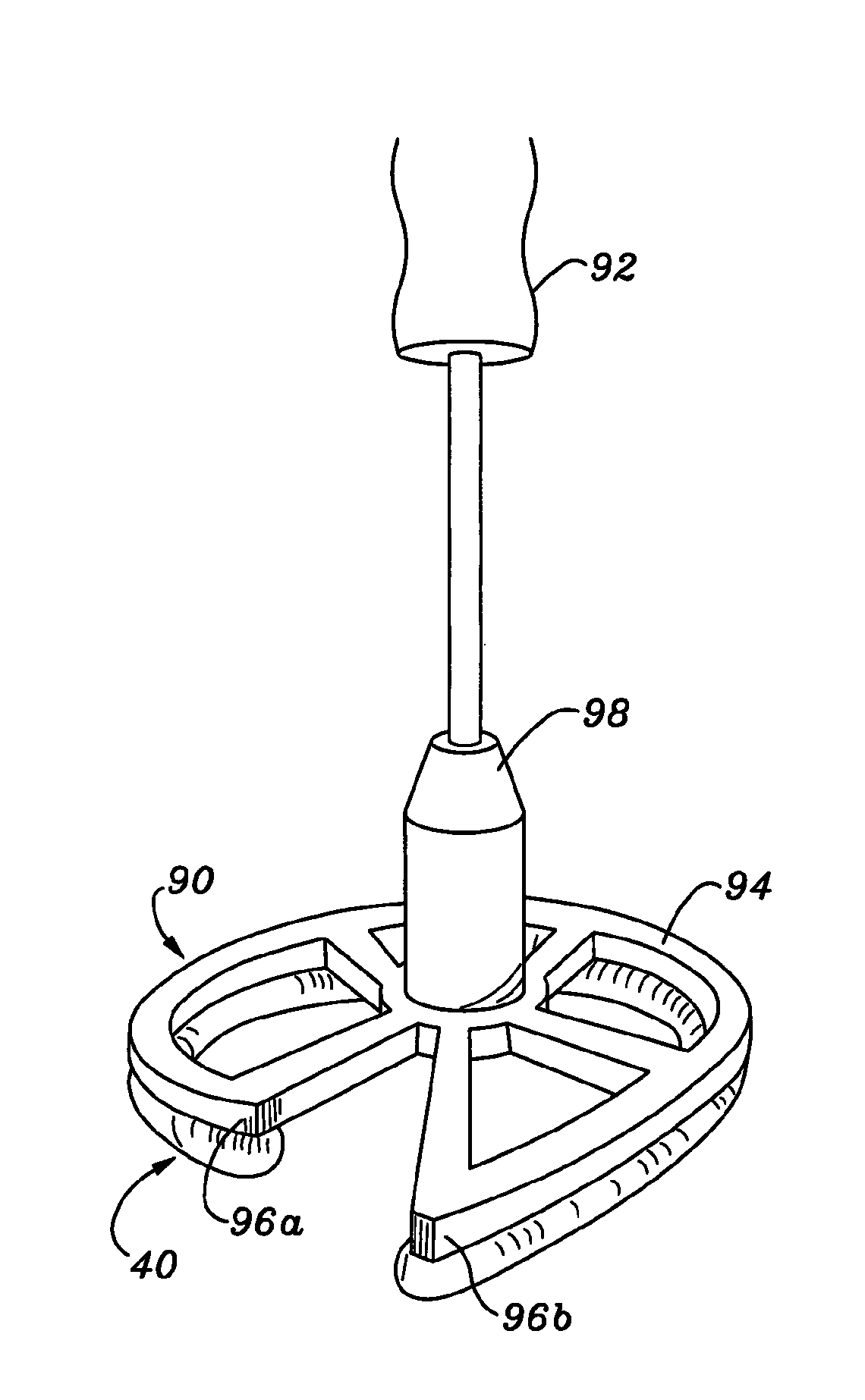 Three-dimensional annuloplasty ring and template