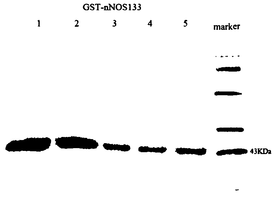 Polypeptide with nNOS-Capon uncoupling activity and application of polypeptide