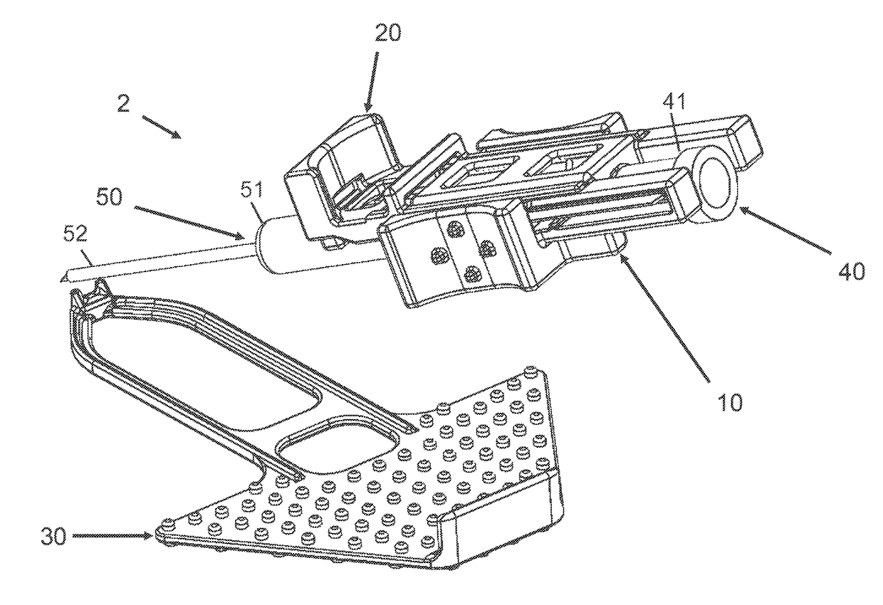 Intravenous access assist device