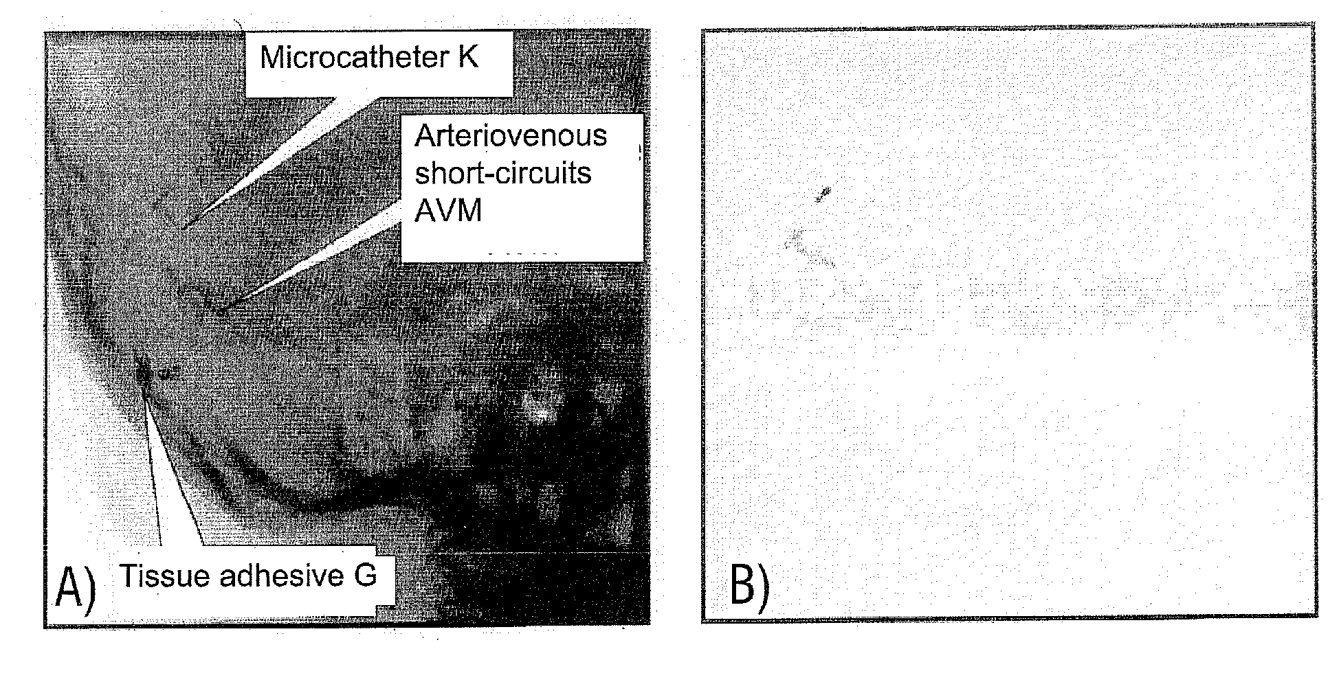 Method for computing a color-coded analysis image