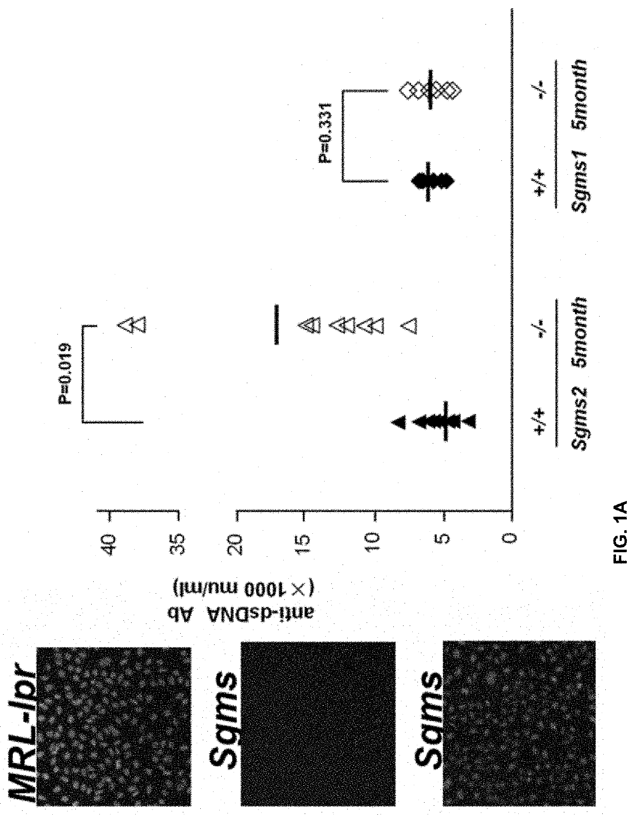 Use of 2-hydroxyoleic acid for the treatment of systemic lupus erythematosus and other immune pathologies