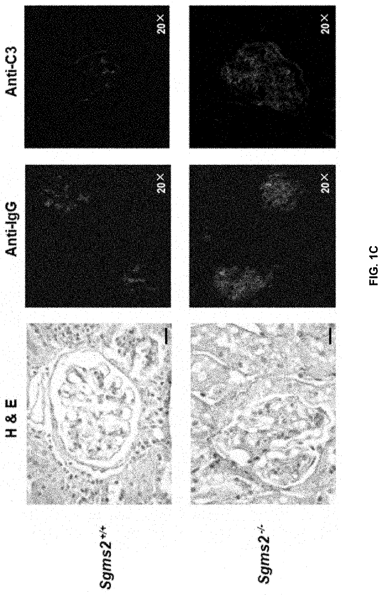 Use of 2-hydroxyoleic acid for the treatment of systemic lupus erythematosus and other immune pathologies