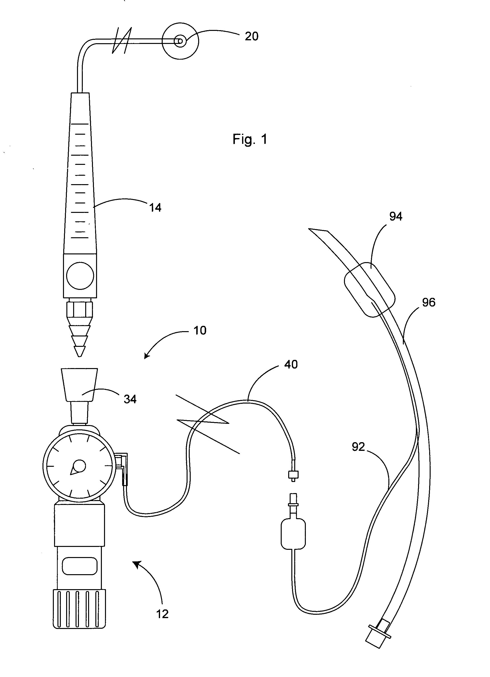 Endotracheal tube cuff pressure regulator