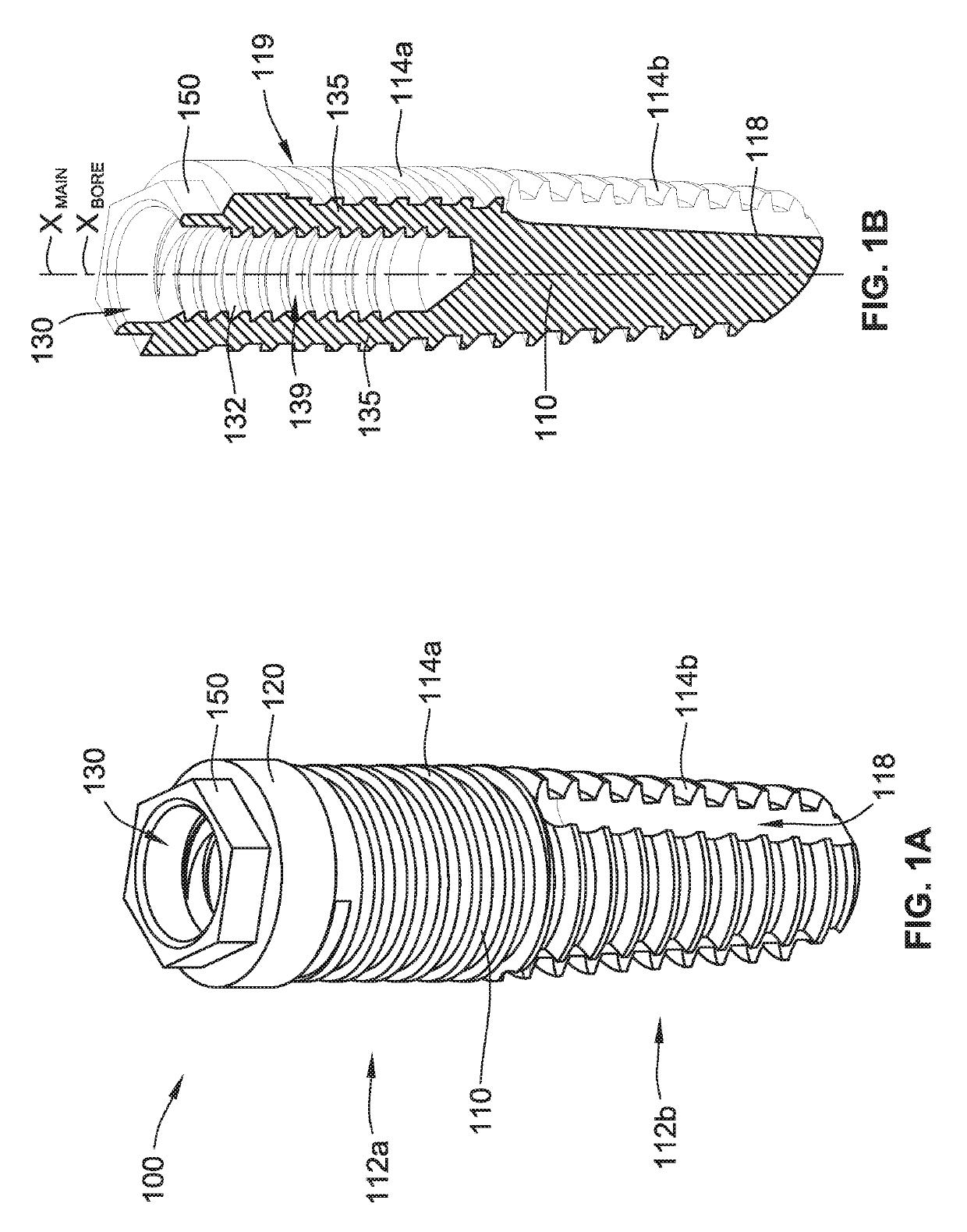 Angulated dental implant