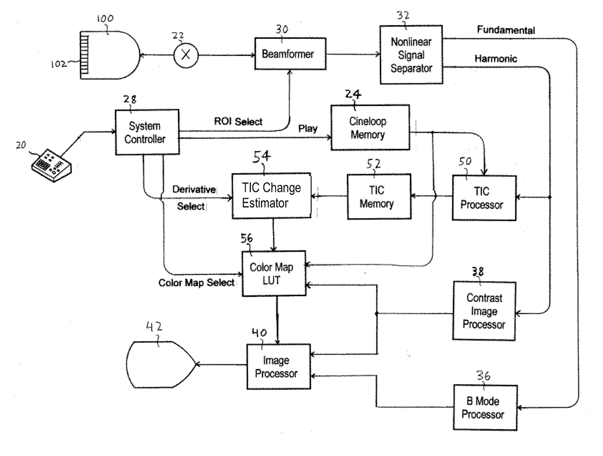 Time-based parametric contrast enhanced ultrasound imaging system and method