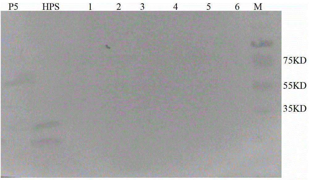 Monoclonal antibody of hemophilus parasuis resistant OMP5 (outer membrane protein), hybridoma cell strain HPS1E2 and application