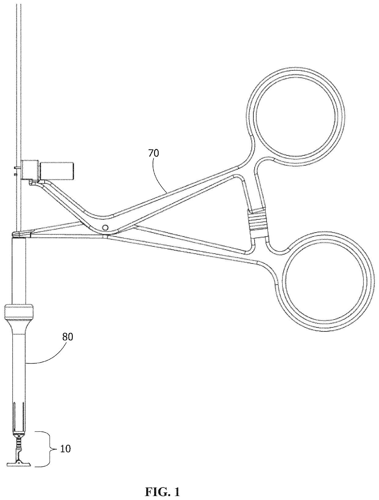 Compression fixation system