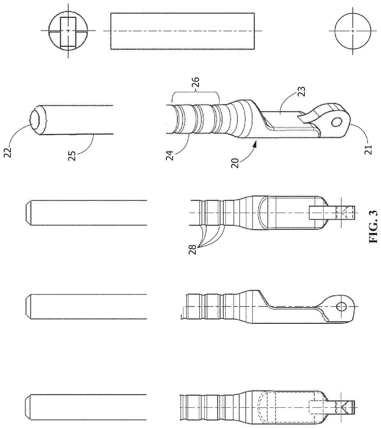 Compression fixation system