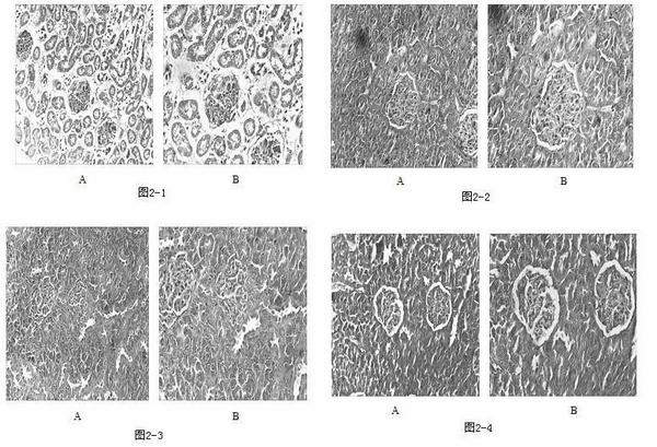 Orthosiphon n-butanol fraction medicine for treating chronic nephritis and preparation method thereof