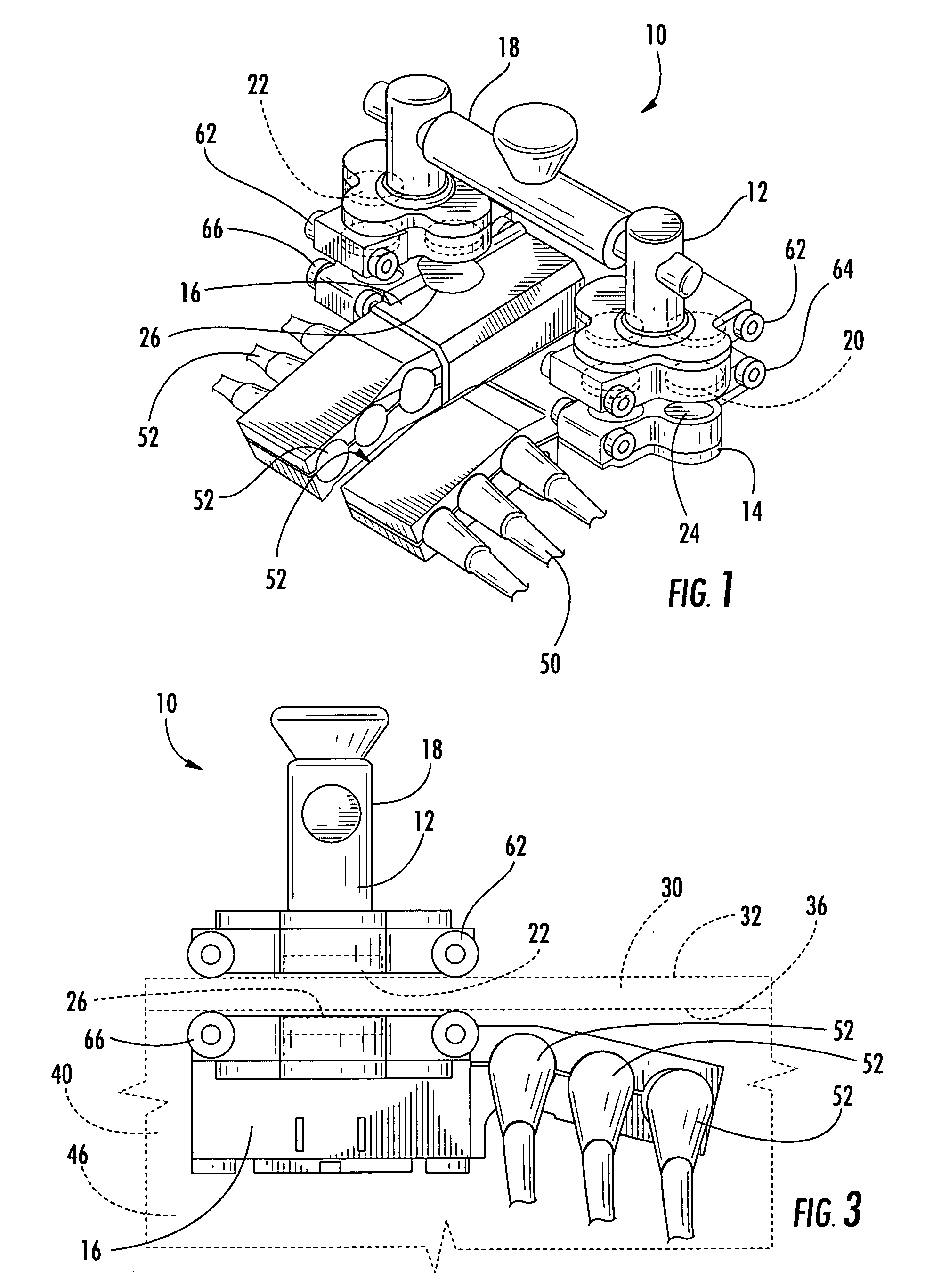 Non-destructive inspection device for inspecting limited-access features of a structure