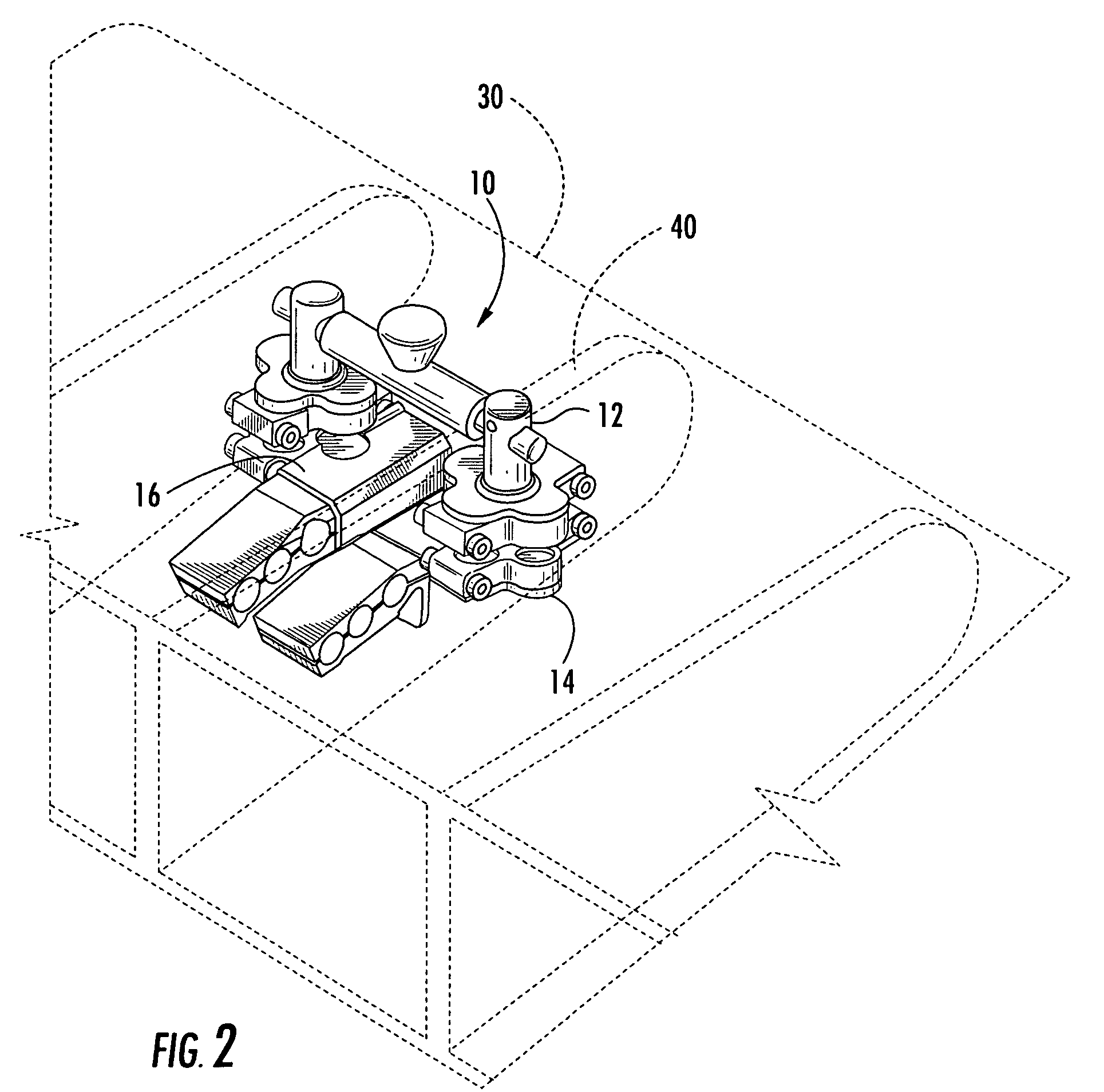 Non-destructive inspection device for inspecting limited-access features of a structure