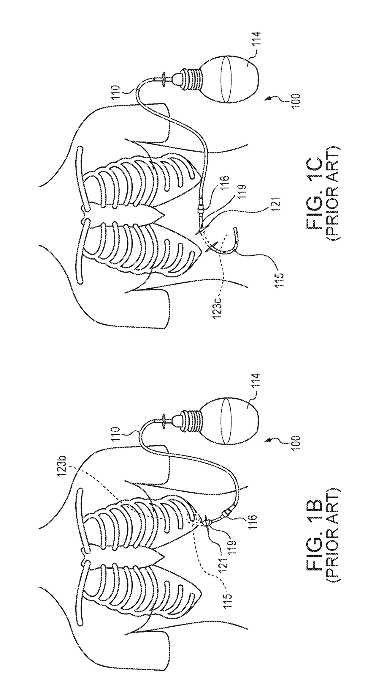 Body cavity drainage catheter with microtextured surface