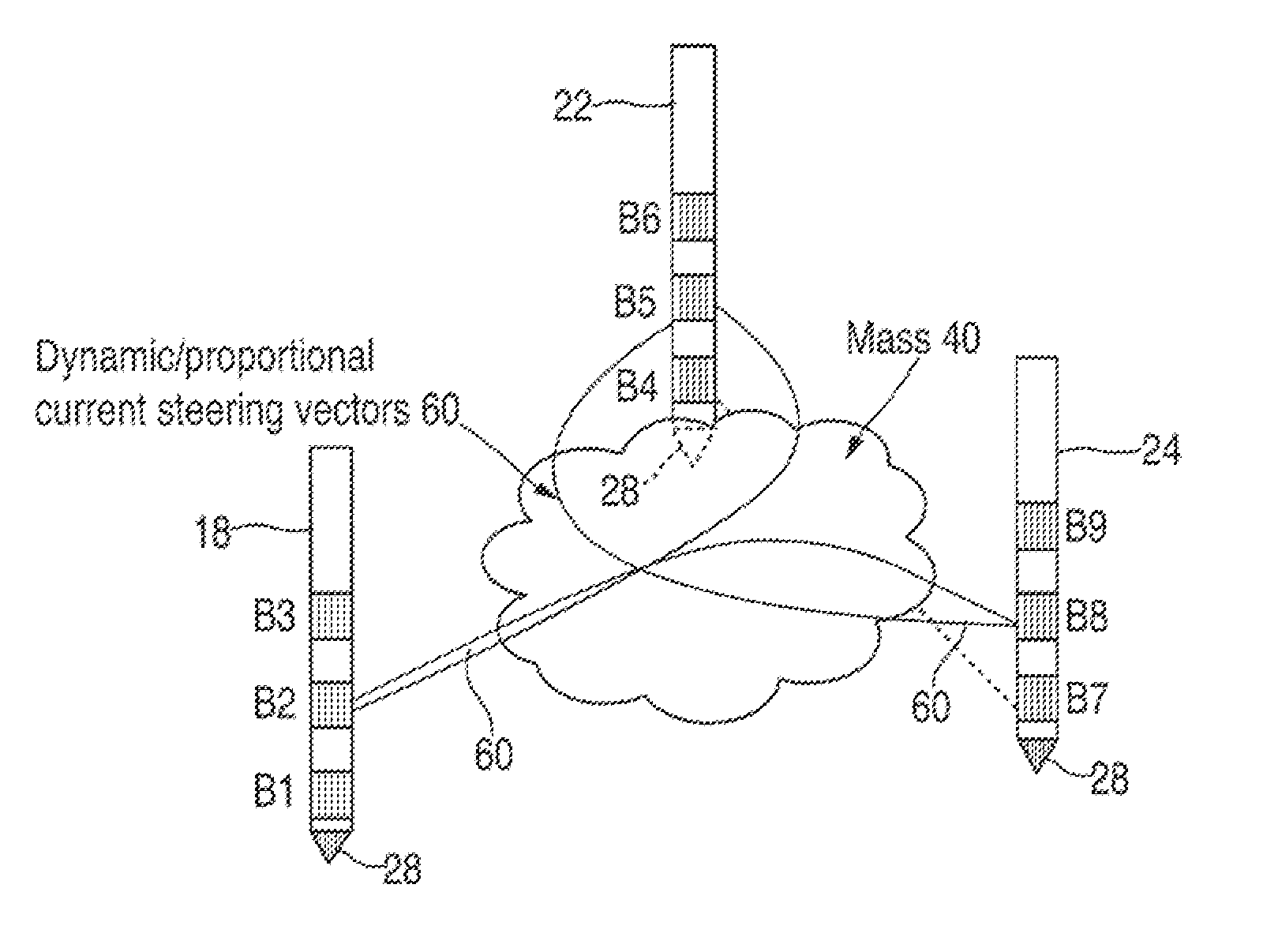 Method for treating benign prostate hyperplasia