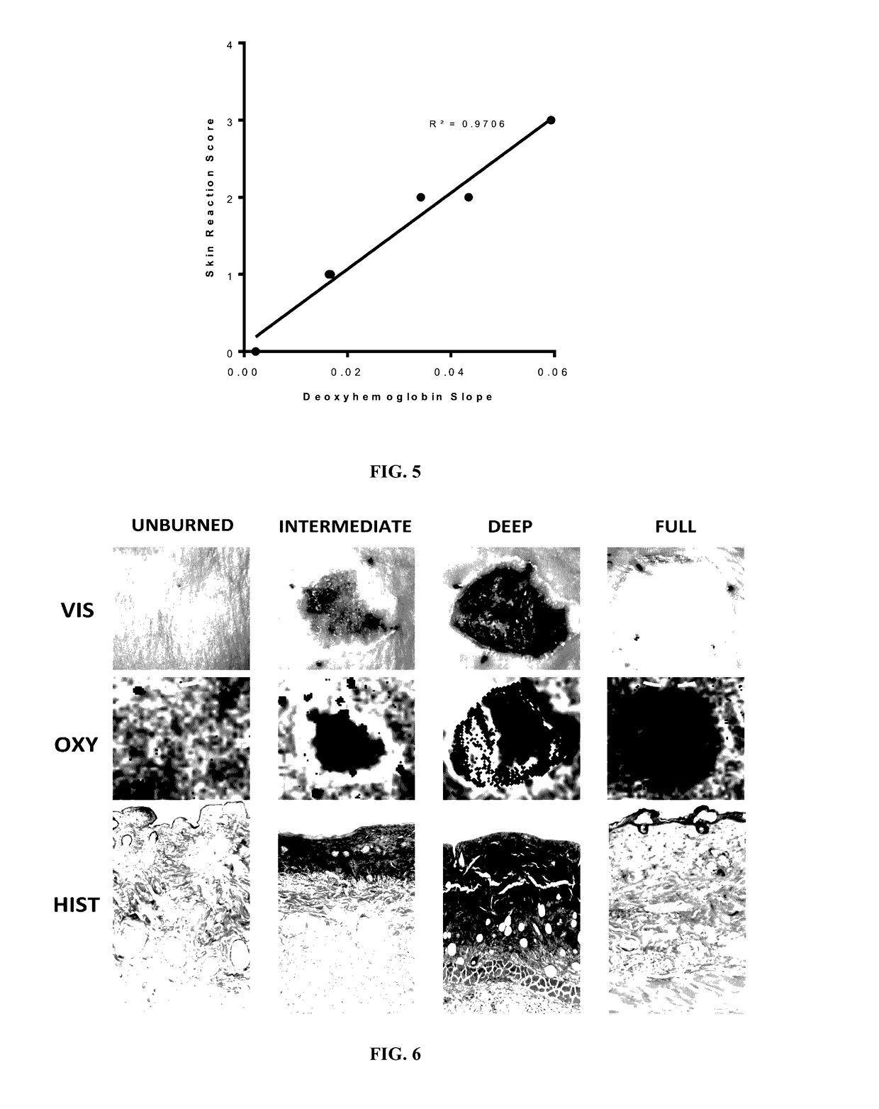 Hyperspectral imaging for prediction of skin injury after exposure to thermal energy or ionizing radiation