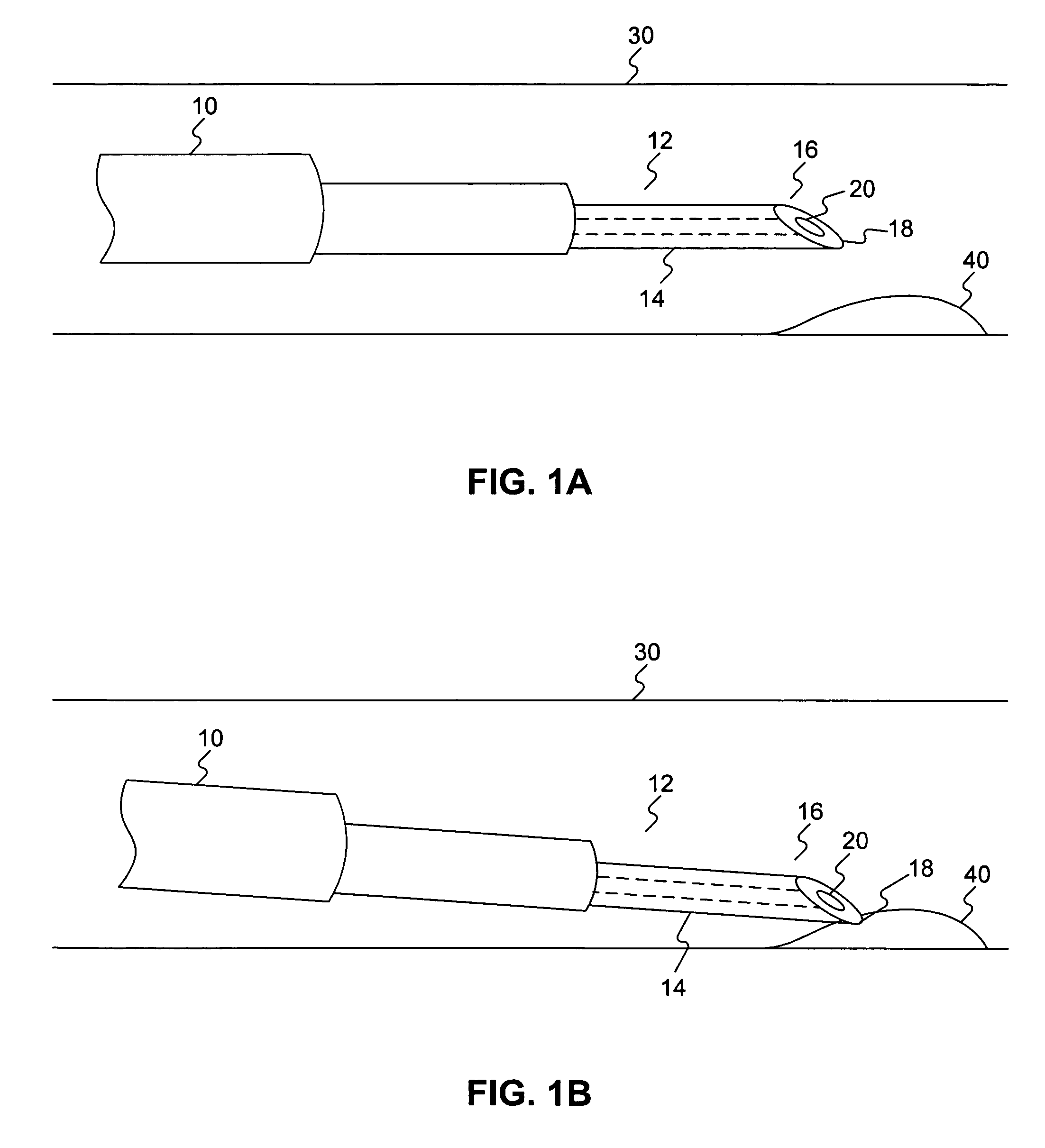 Endoscopic resection method