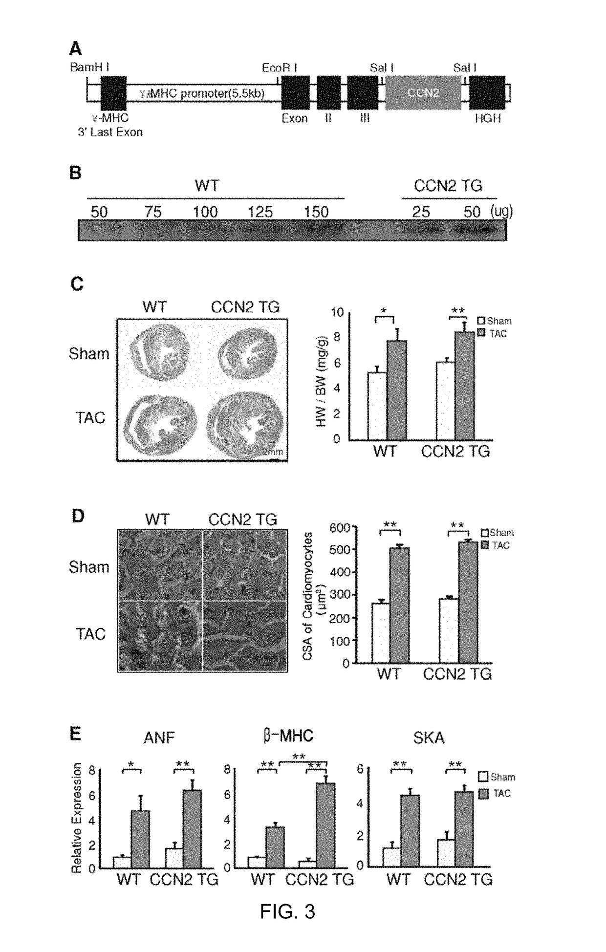 Pharmaceutical composition comprising CCN5 for reducing cardiac fibrosis in a subject in need thereof