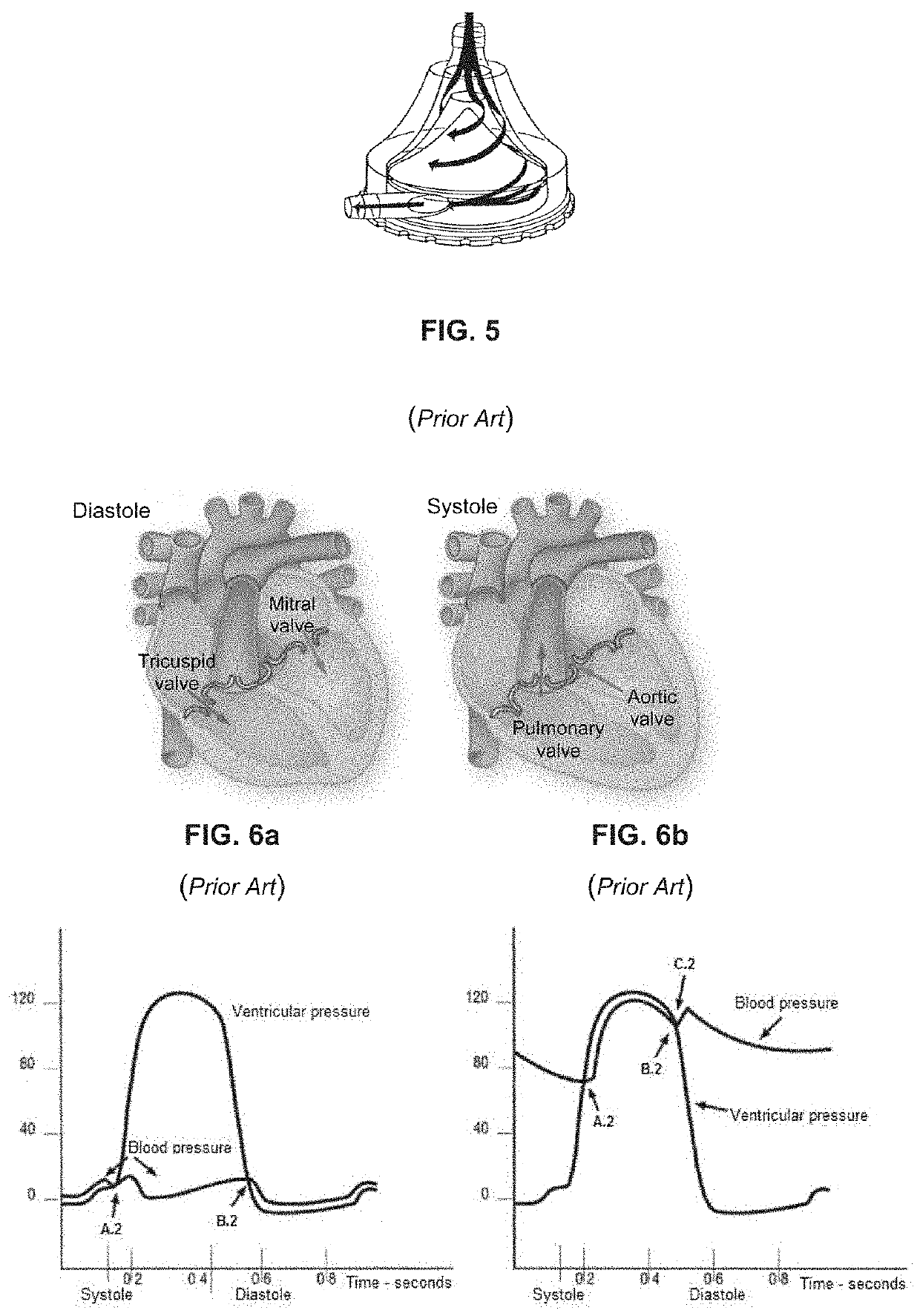 Pump for artificial circulatory assistance and a pumping system