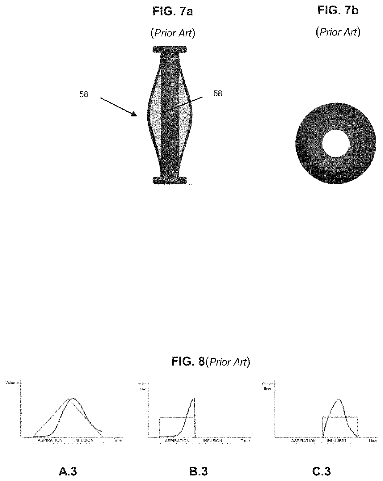 Pump for artificial circulatory assistance and a pumping system