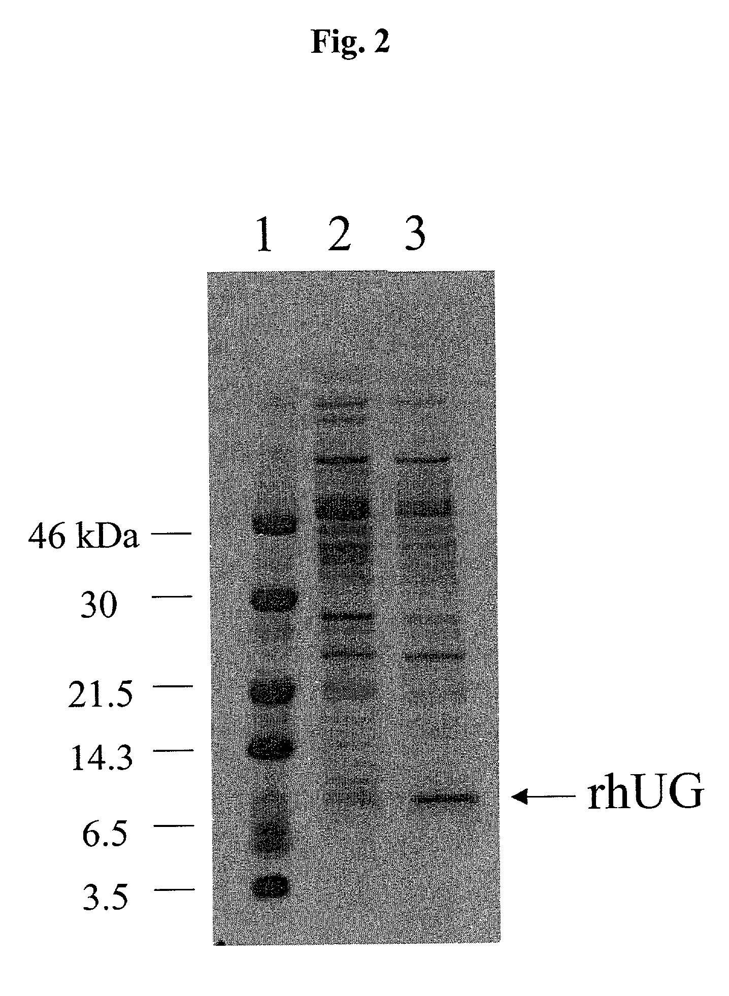 Methods for the production of purified recombinant human uteroglobin for the treatment of inflammatory and fibrotic conditions