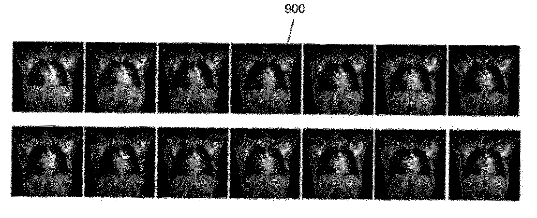 Detection of Landmarks and Key-frames in Cardiac Perfusion MRI Using a Joint Spatial-Temporal Context Model