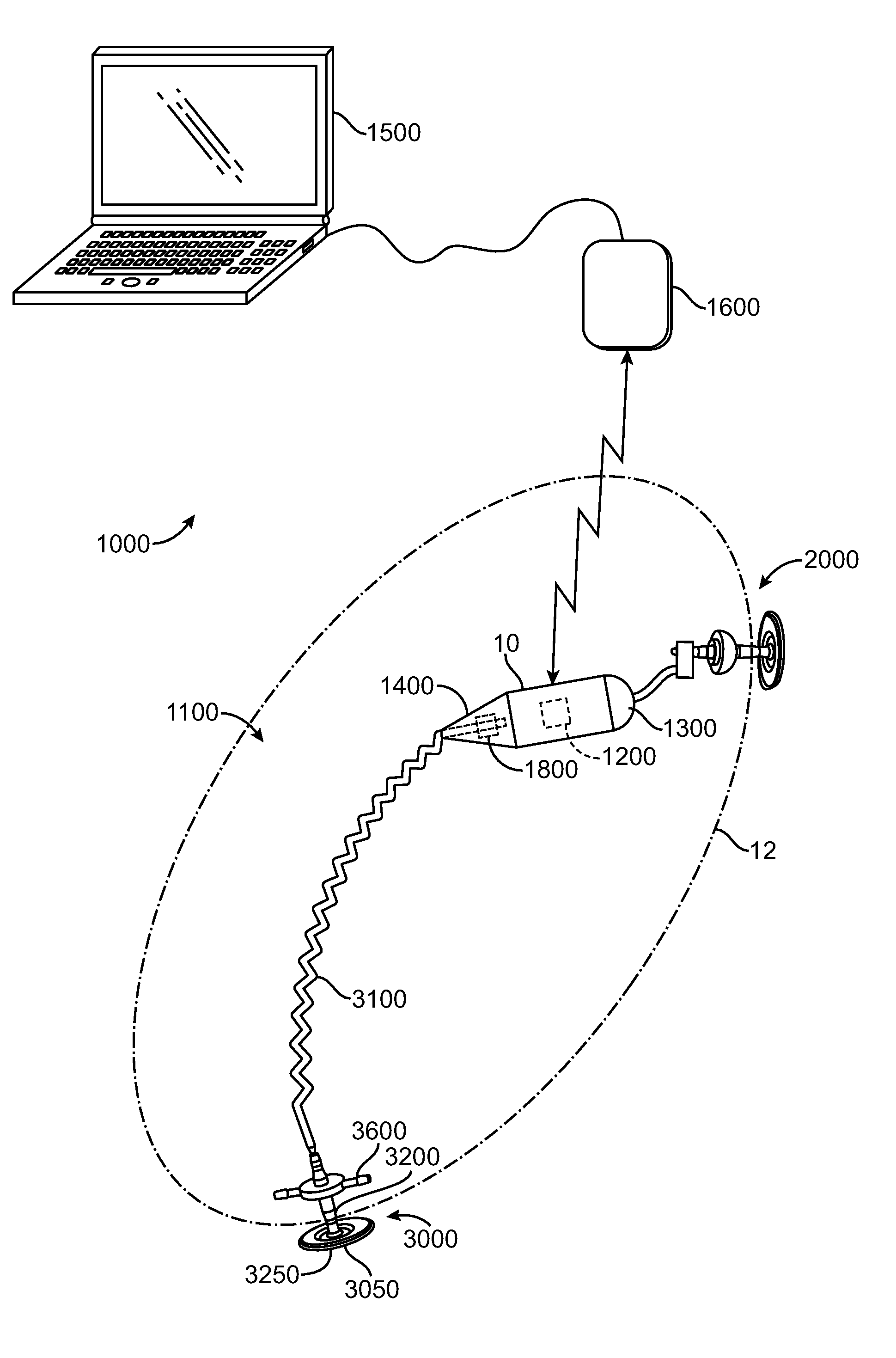 Sensor Driven Gastric Stimulation for Patient Management