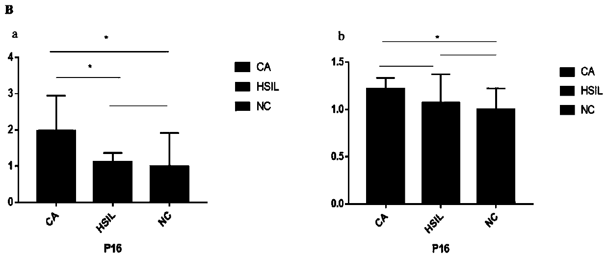 Cervical cancer staging method based on cervical exfoliated cell gene detection, and detection kit