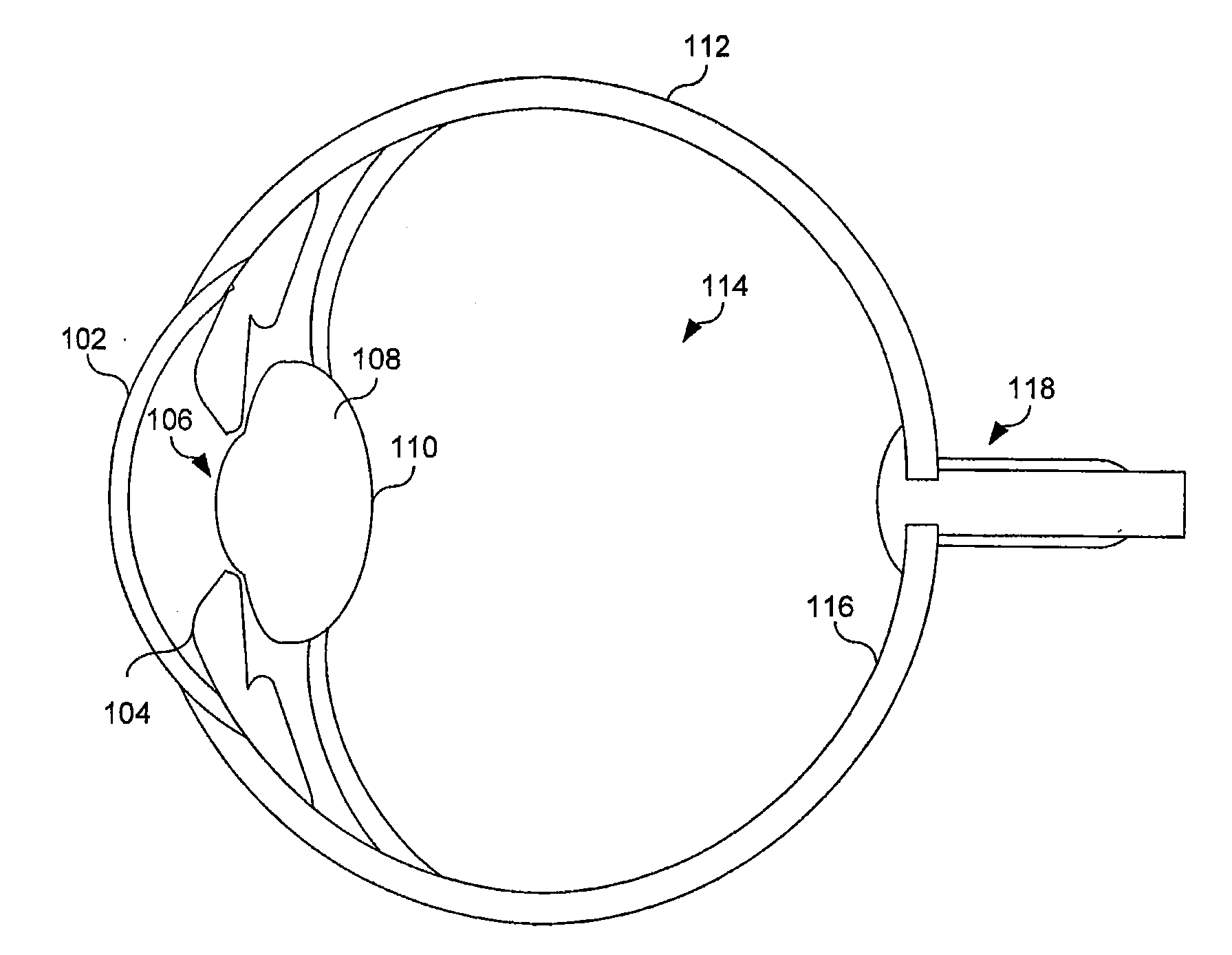 Reduced profile intraocular lens