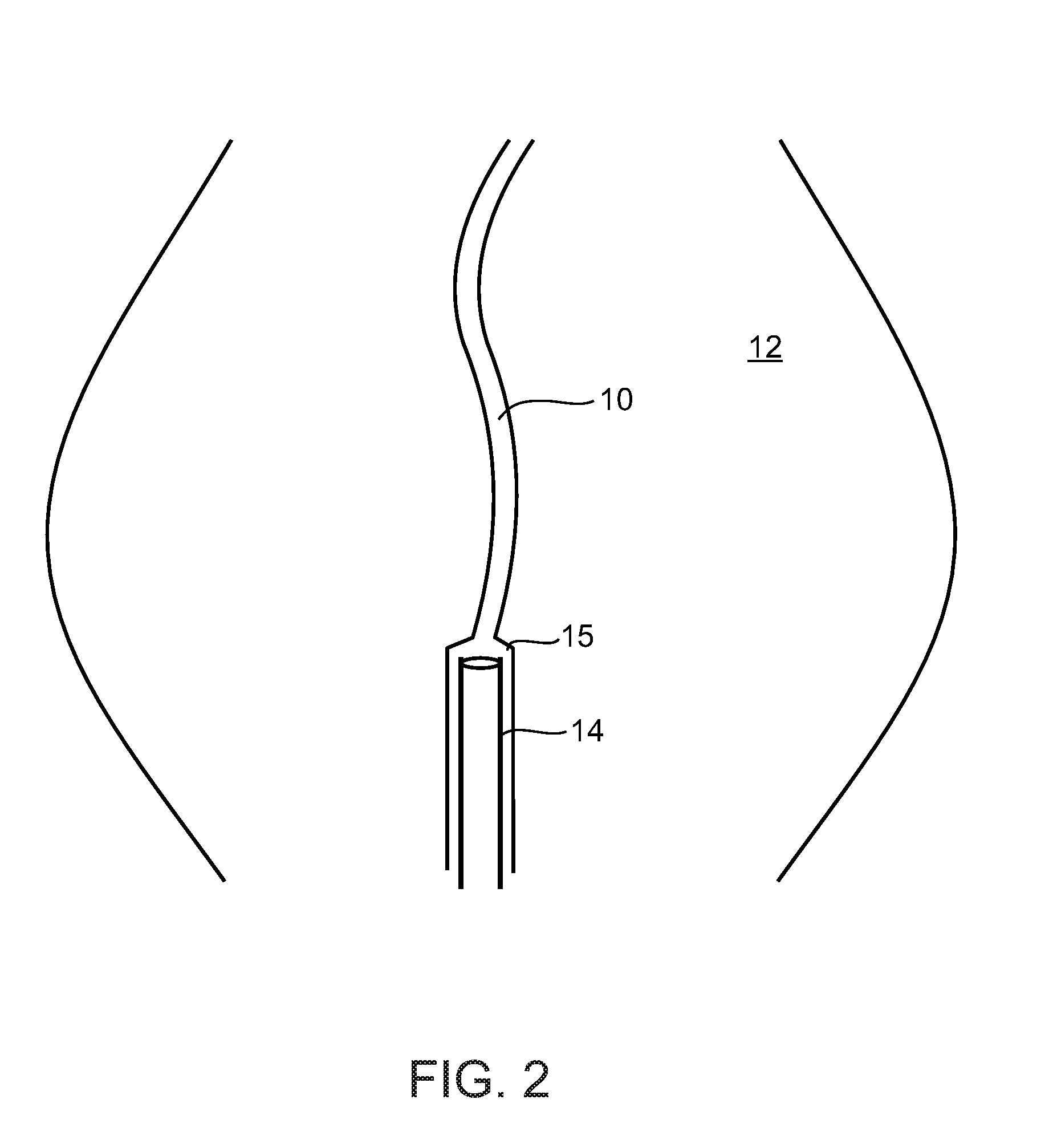 Methods and devices for urethral treatment