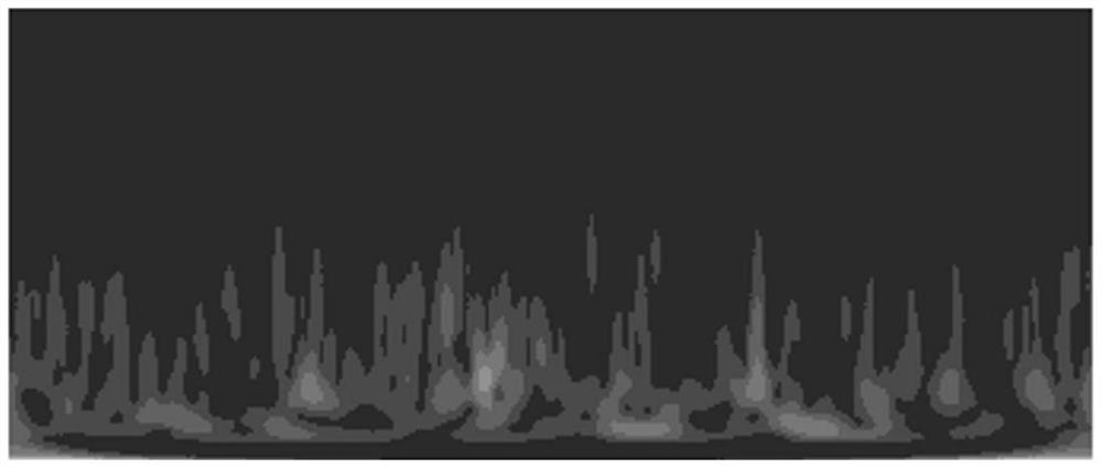 Electroencephalogram signal denoising method based on residual generative adversarial network