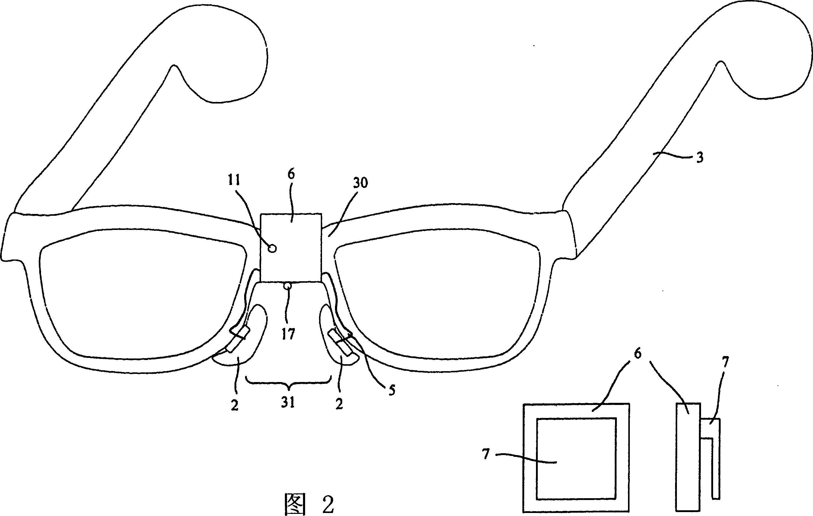 Nasal bone conduction hearing aid