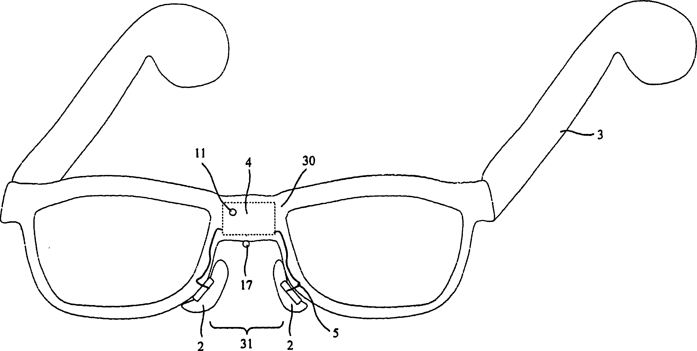 Nasal bone conduction hearing aid