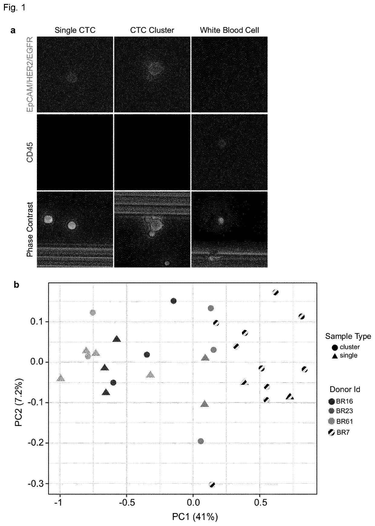 Na+/k+ atpase inhibitors for use in the prevention or treatment of metastasis