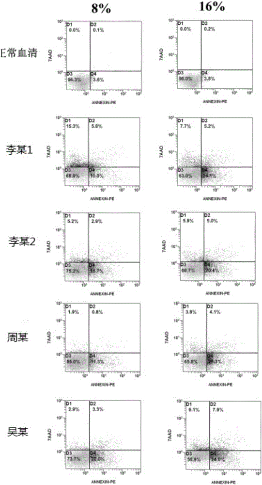 Malaria serum with anti-tumor function and preparation method and application of malaria serum with anti-tumor function