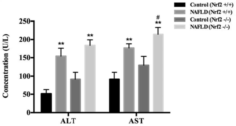 Application of ellagic acid to preparation of medicine for preventing and/or treating nonalcoholic fatty liver disease and liver injury