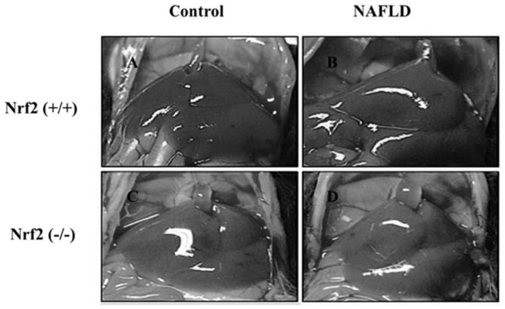 Application of ellagic acid to preparation of medicine for preventing and/or treating nonalcoholic fatty liver disease and liver injury